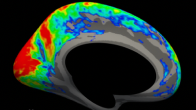 Research & Clinical Trials