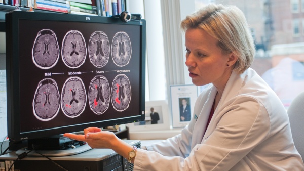 Dr. Rost looking at brain imaging slides Dr. Rost looking at brain imaging slides