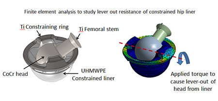 Computational Modeling and FEA of Implant Designs, Figure 3, Harris Orthopaedics Laboratory, Department of Orthopaedic Surgery, Mass General