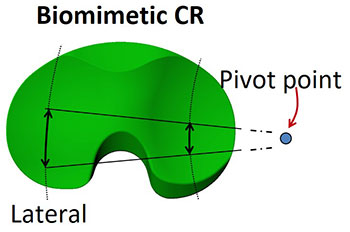 Harris Lab, Transitional Research, Implant Design