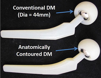 Harris Lab, Transitional Research, Addressing Soft-Tissue Impingement with Large Diameter Hip Implants