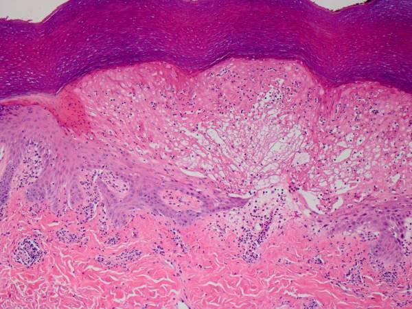 A microscope slide dyed bright pink for contrast A microscope slide dyed bright pink for contrast