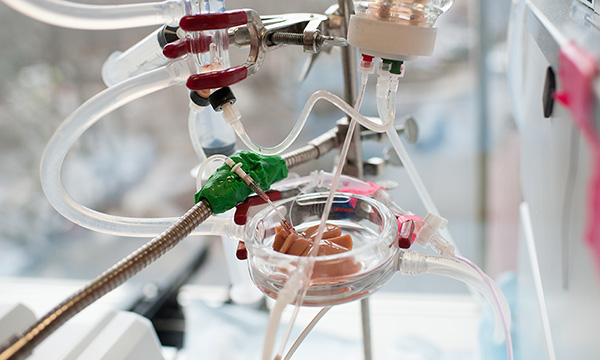 A piece of engineered tissue being created A piece of engineered tissue being created