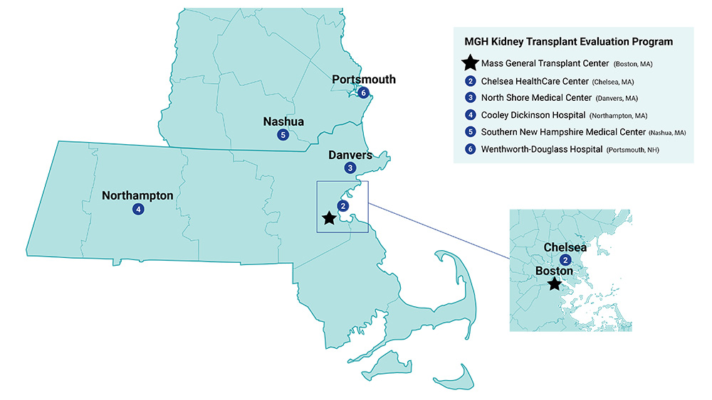 map showing kidney transplant evaluation locations